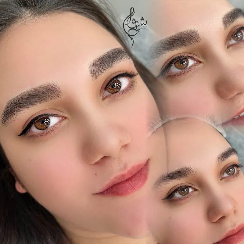 فیبروز کرکی موی